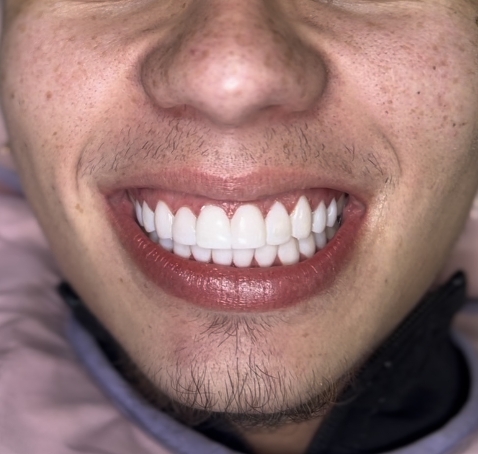 Before image